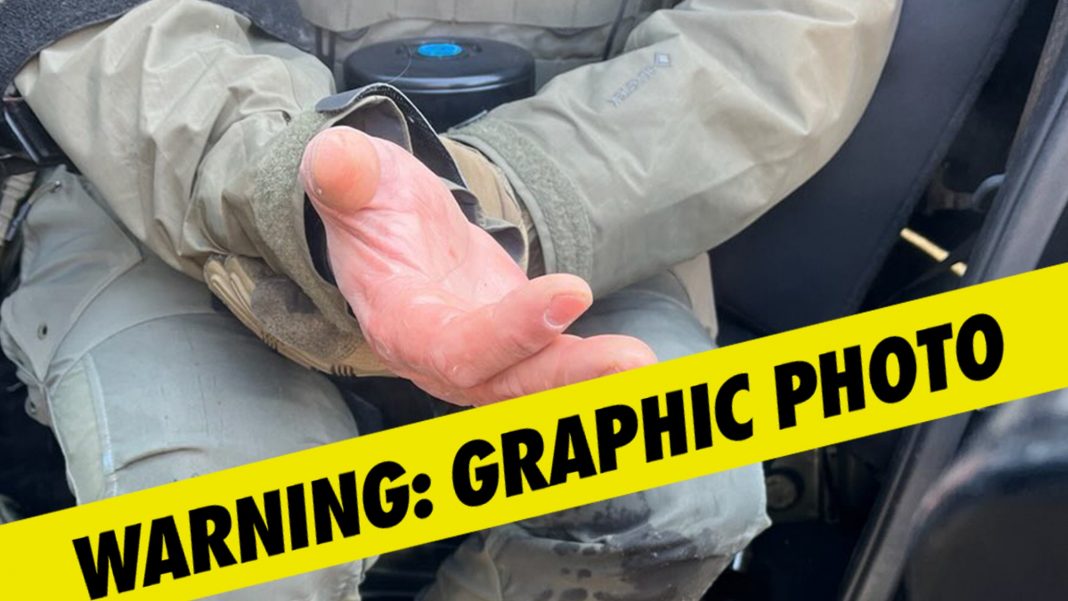 Homeland Security Assistant Secretary Claims Rioters Bit Off Agent’s Finger in Minnesota