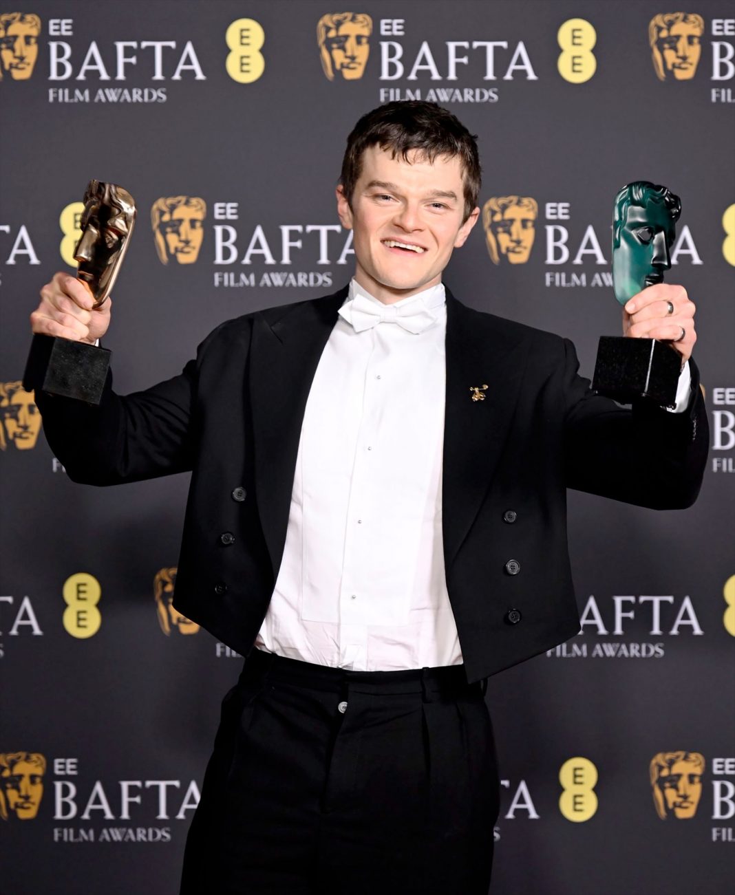 Robert Aramayo Wins the BAFTA Award for 'I Swear' - He Deserves It